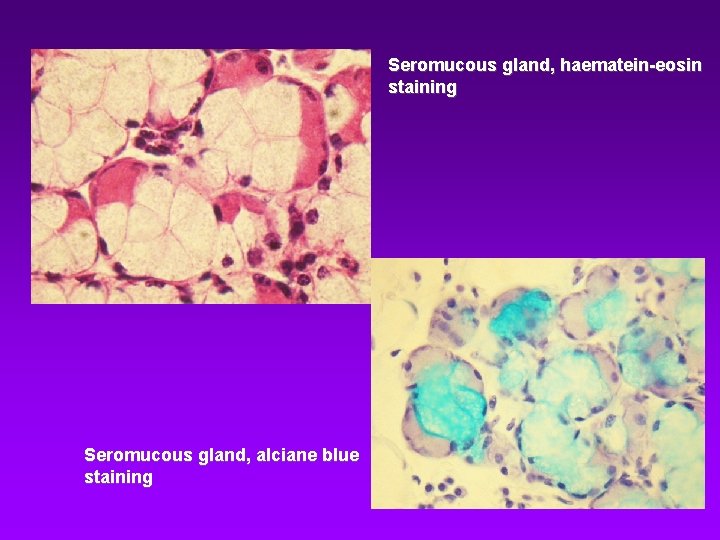 Seromucous gland, haematein-eosin staining Seromucous gland, alciane blue staining Seromucous gland, haematein-eosin staining Seromucous gland, alciane blue staining