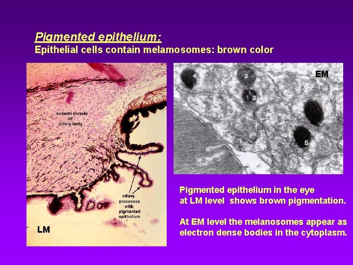 Pigmented epithelium: Epithelial cells contain melamosomes: brown color EM Pigmented epithelium in the eye Pigmented epithelium: Epithelial cells contain melamosomes: brown color EM Pigmented epithelium in the eye