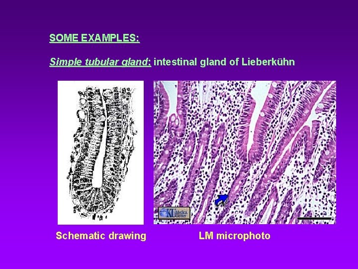 SOME EXAMPLES: Simple tubular gland: intestinal gland of Lieberkühn Schematic drawing LM microphoto 