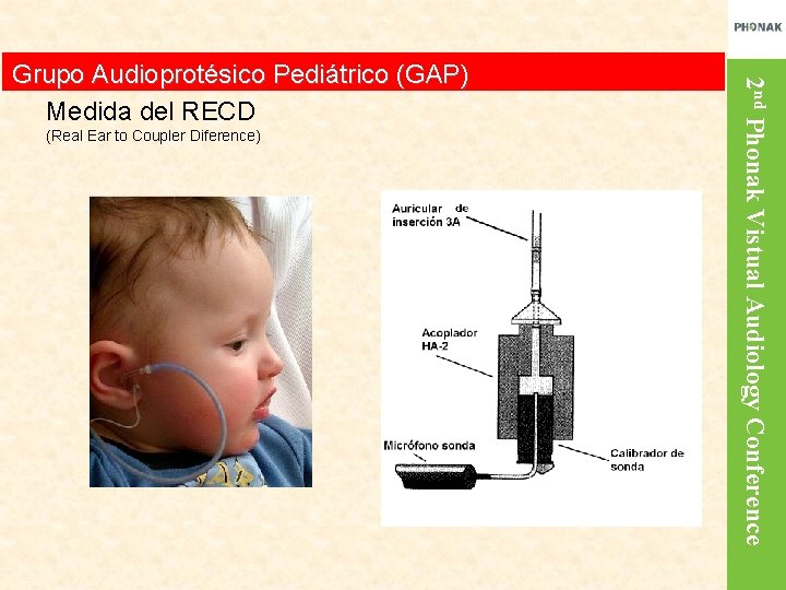 (Real Ear to Coupler Diference) 2 nd Phonak Vistual Audiology Conference Grupo Audioprotésico Pediátrico