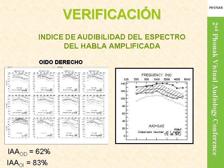 INDICE DE AUDIBILIDAD DEL ESPECTRO DEL HABLA AMPLIFICADA OIDO DERECHO IAAOD = 62% IAAOI