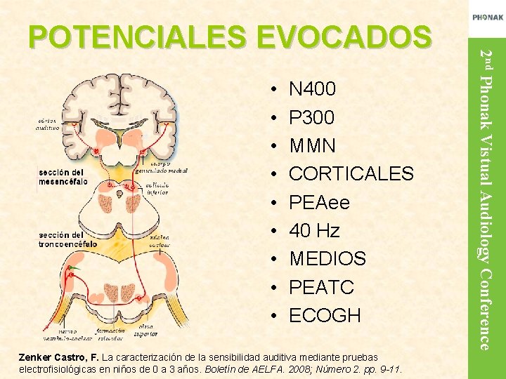  • • • N 400 P 300 MMN CORTICALES PEAee 40 Hz MEDIOS