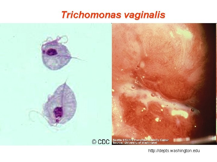 Trichomonas vaginalis http: //depts. washington. edu 