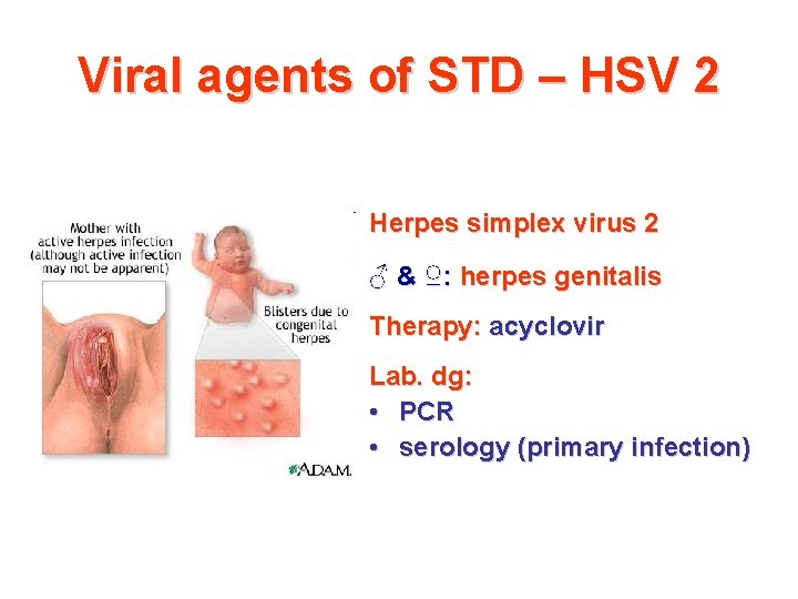 Viral agents of STD – HSV 2 Herpes simplex virus 2 ♂ & ♀: