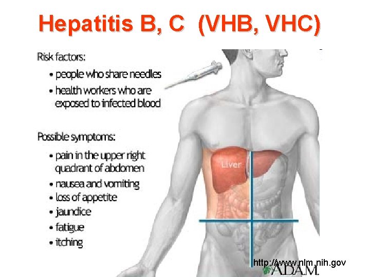 Hepatitis B, C (VHB, VHC) http: //www. nlm. nih. gov 