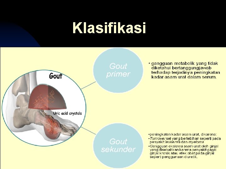 Klasifikasi 