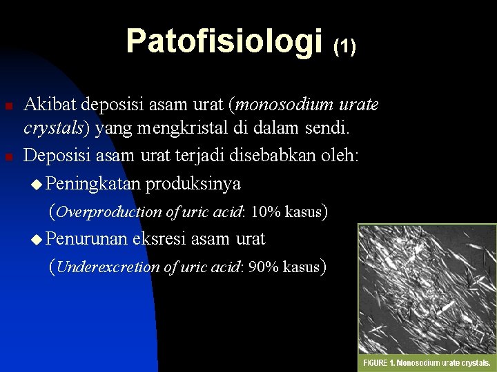 Patofisiologi (1) n n Akibat deposisi asam urat (monosodium urate crystals) yang mengkristal di