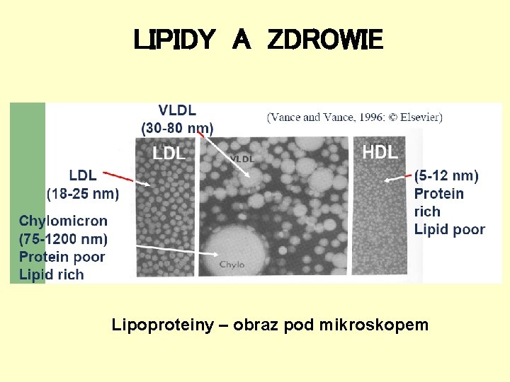 LIPIDY A ZDROWIE Lipoproteiny – obraz pod mikroskopem 