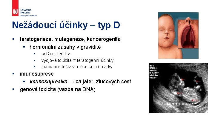 Nežádoucí účinky – typ D § teratogeneze, mutageneze, kancerogenita § hormonální zásahy v graviditě