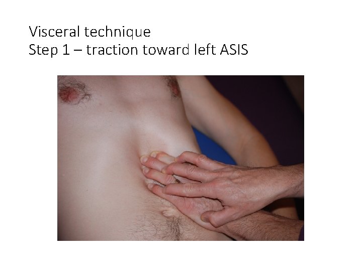 Visceral technique Step 1 – traction toward left ASIS 