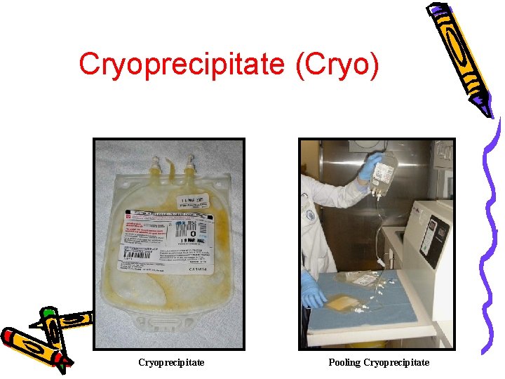 Cryoprecipitate (Cryo) Cryoprecipitate Pooling Cryoprecipitate 