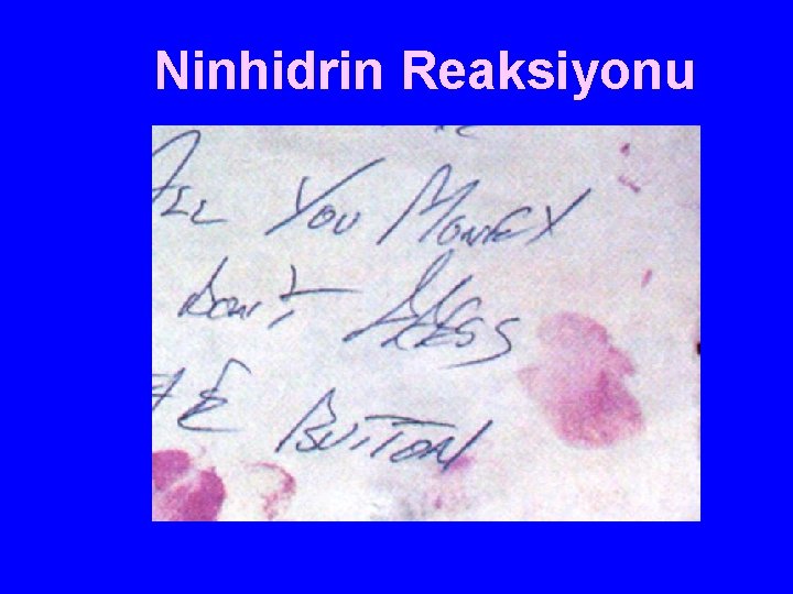 Ninhidrin Reaksiyonu 
