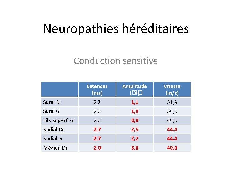 Neuropathies héréditaires Conduction sensitive Latences (ms) Amplitude (�� V) Vitesse (m/s) Sural Dr 2,