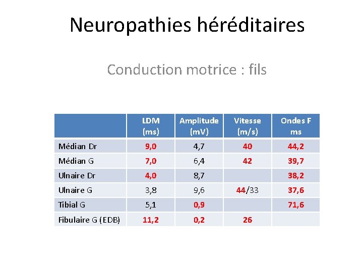 Neuropathies héréditaires Conduction motrice : fils LDM (ms) Amplitude (m. V) Vitesse (m/s) Ondes