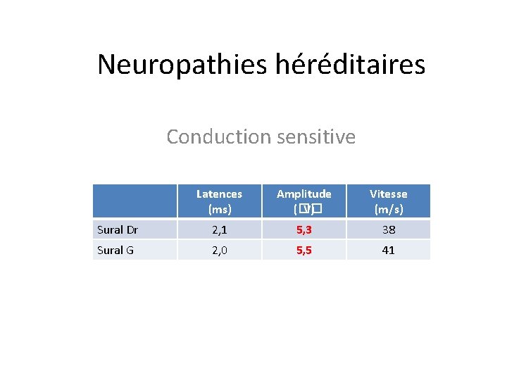 Neuropathies héréditaires Conduction sensitive Latences (ms) Amplitude (�� V) Vitesse (m/s) Sural Dr 2,