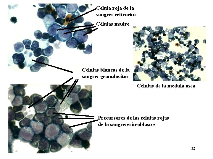 Celula roja de la sangre: eritrocito Células madre Celulas blancas de la sangre: granulocitos Celula roja de la sangre: eritrocito Células madre Celulas blancas de la sangre: granulocitos