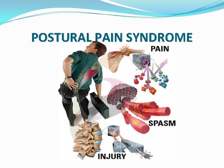 POSTURAL PAIN SYNDROME 