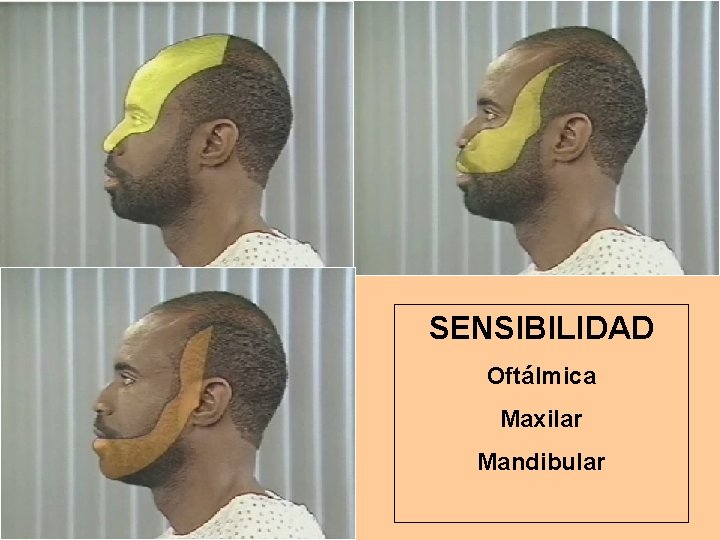 SENSIBILIDAD Oftálmica Maxilar Mandibular 