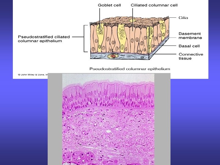 Pseudostratified 