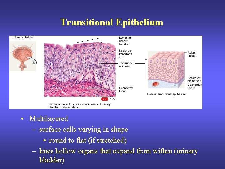 Transitional Epithelium • Multilayered – surface cells varying in shape • round to flat