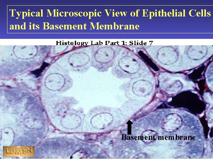 Typical Microscopic View of Epithelial Cells and its Basement Membrane Basement membrane 