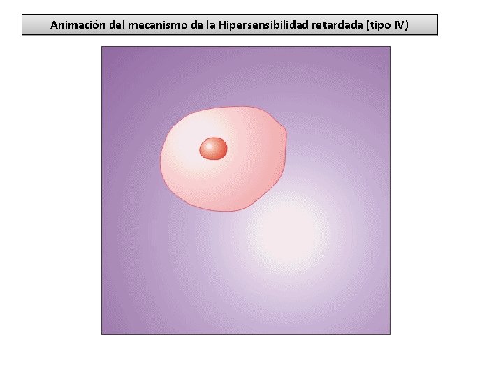 Animación del mecanismo de la Hipersensibilidad retardada (tipo IV) Animación del mecanismo de la Hipersensibilidad retardada (tipo IV)