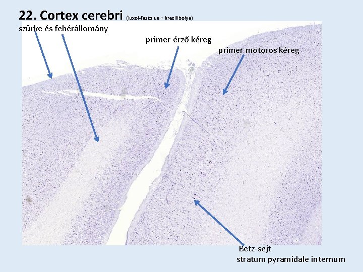 22. Cortex cerebri szürke és fehérállomány (luxol-fastblue + krezilibolya) primer érző kéreg primer motoros