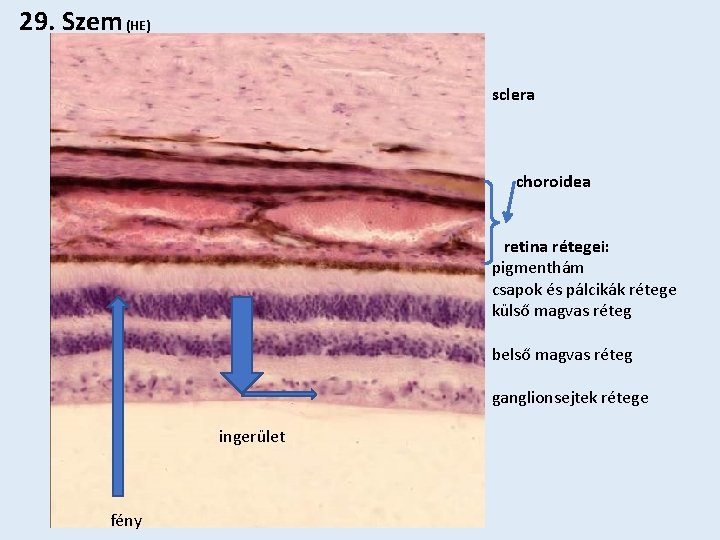 29. Szem (HE) sclera choroidea retina rétegei: pigmenthám csapok és pálcikák rétege külső magvas