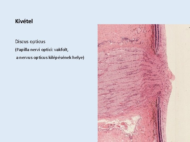 Kivétel Discus opticus (Papilla nervi optici: vakfolt, a nervus opticus kilépésének helye) 