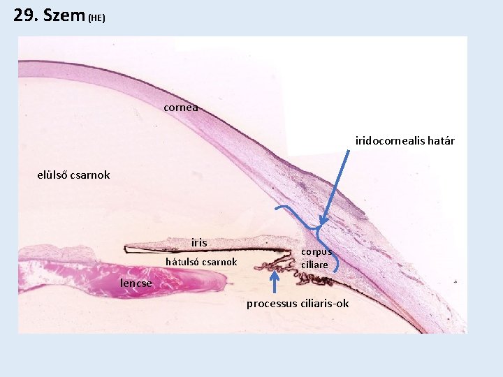 29. Szem (HE) cornea iridocornealis határ elülső csarnok iris hátulsó csarnok corpus ciliare lencse