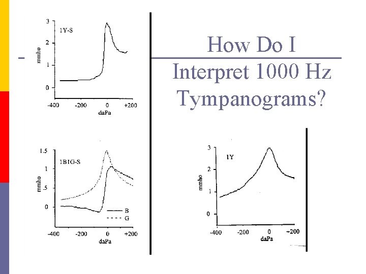 How Do I Interpret 1000 Hz Tympanograms? 