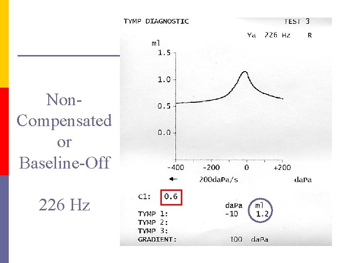 Non. Compensated or Baseline-Off 226 Hz 