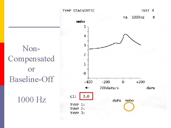 Non. Compensated or Baseline-Off 1000 Hz 