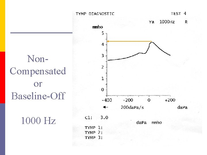 Non. Compensated or Baseline-Off 1000 Hz 