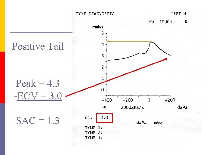 Positive Tail Peak = 4. 3 -ECV = 3. 0 SAC = 1. 3