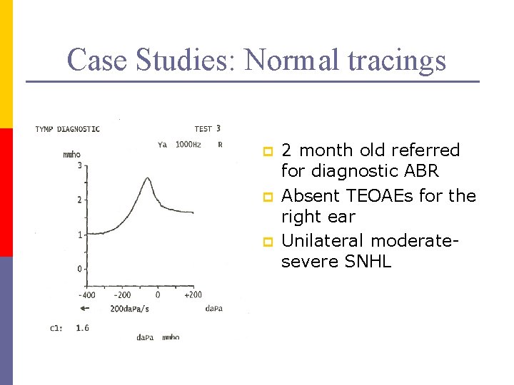 Case Studies: Normal tracings p p p 2 month old referred for diagnostic ABR