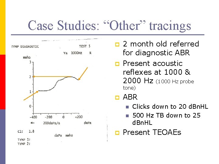 Case Studies: “Other” tracings p p 2 month old referred for diagnostic ABR Present