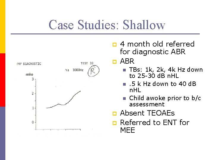 Case Studies: Shallow p p 4 month old referred for diagnostic ABR n n