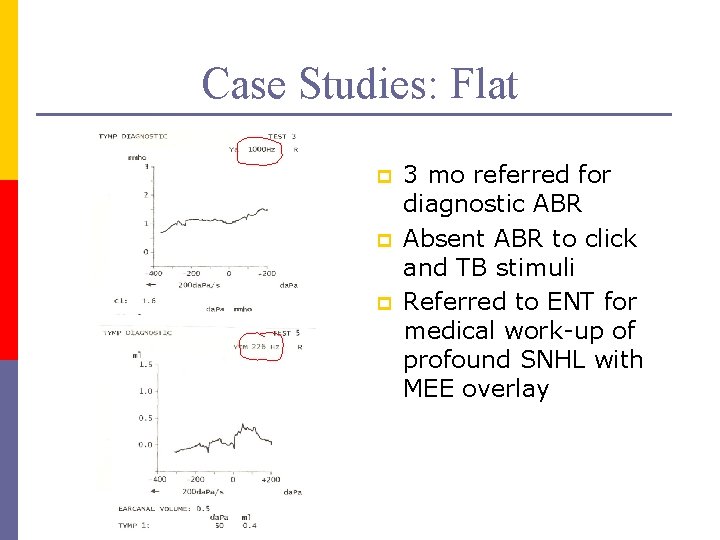 Case Studies: Flat p p p 3 mo referred for diagnostic ABR Absent ABR