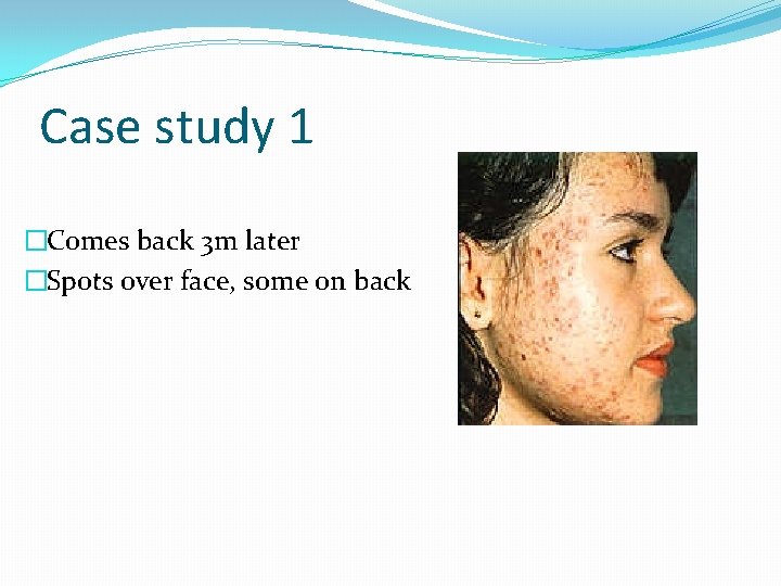Case study 1 �Comes back 3 m later �Spots over face, some on back