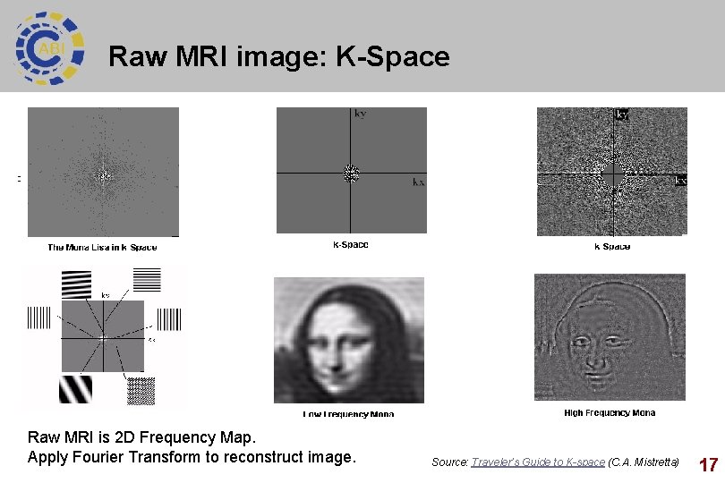 Raw MRI image: K-Space Raw MRI is 2 D Frequency Map. Apply Fourier Transform