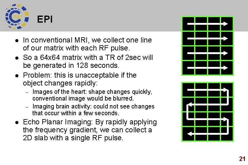 EPI l l l In conventional MRI, we collect one line of our matrix