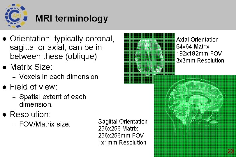 MRI terminology l l Orientation: typically coronal, sagittal or axial, can be inbetween these