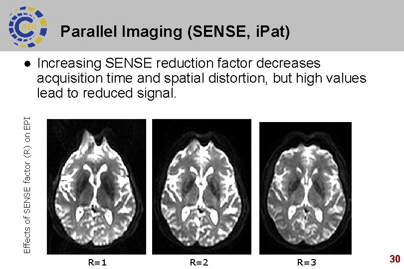 Parallel Imaging (SENSE, i. Pat) Increasing SENSE reduction factor decreases acquisition time and spatial