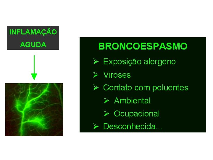 INFLAMAÇÃO AGUDA BRONCOESPASMO Ø Exposição alergeno Ø Viroses Ø Contato com poluentes Ø Ambiental