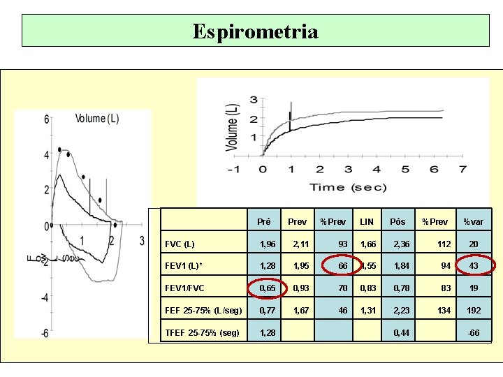 Espirometria Pré Prev %Prev LIN Pós %Prev %var FVC (L) 1, 96 2, 11