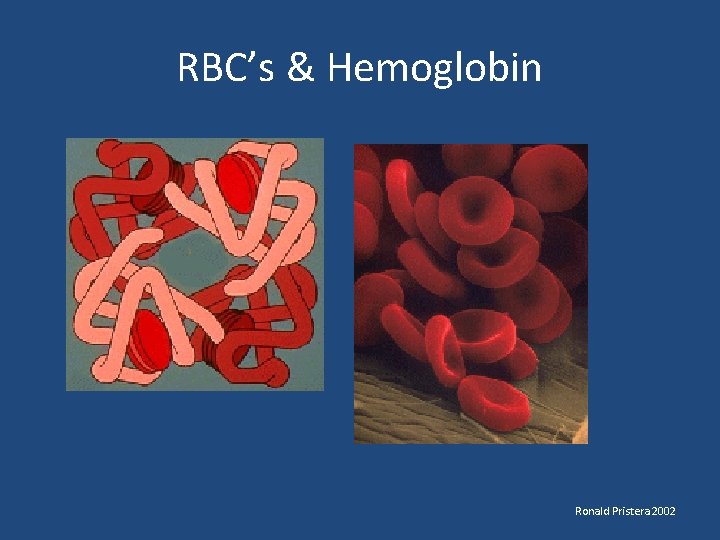 RBC’s & Hemoglobin Ronald Pristera 2002 