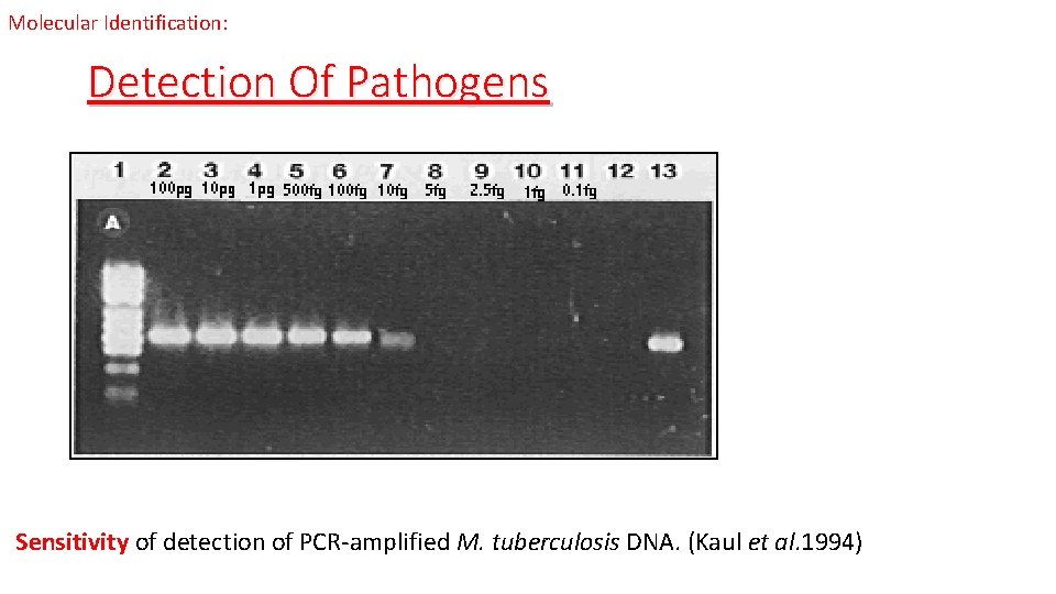 Molecular Identification: Detection Of Pathogens Sensitivity of detection of PCR-amplified M. tuberculosis DNA. (Kaul