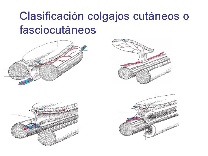 Clasificación colgajos cutáneos o fasciocutáneos 