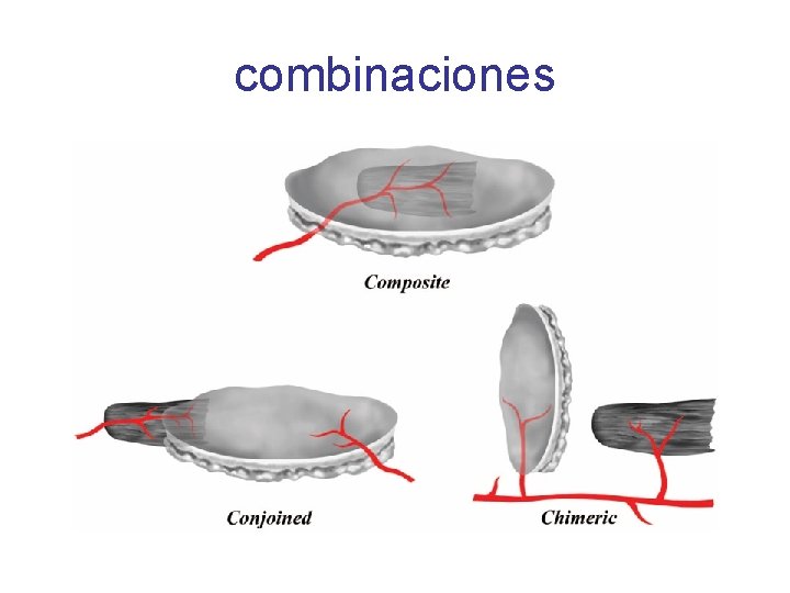 combinaciones 